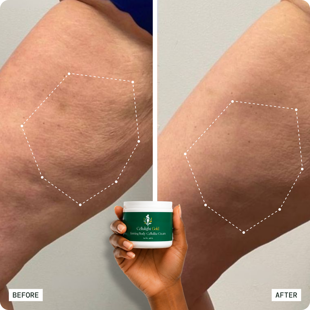 Cellulite cream before and after results