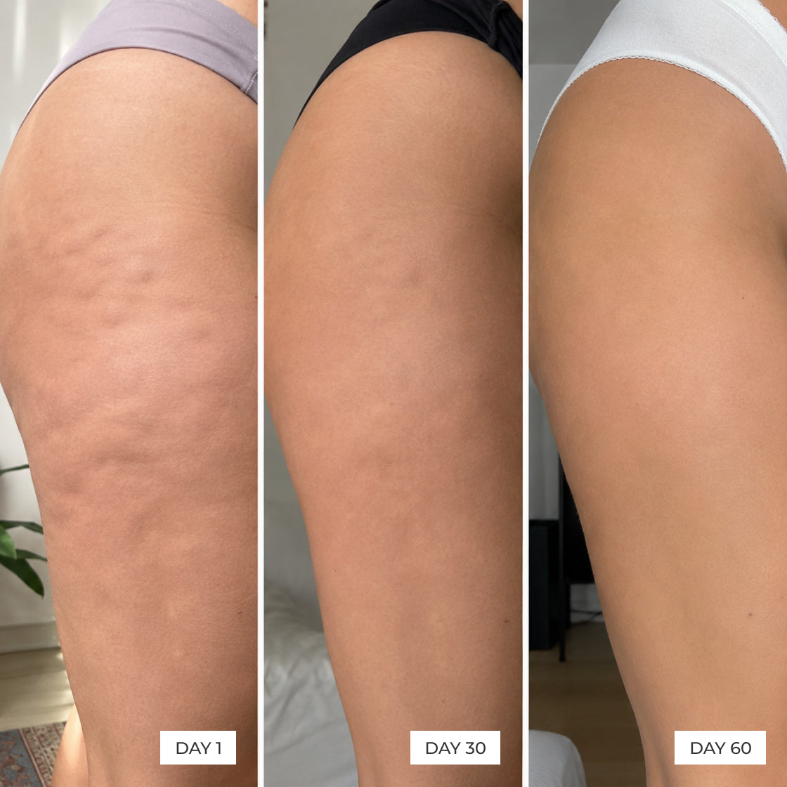 Cellulite appearance results from day 1 to day 60